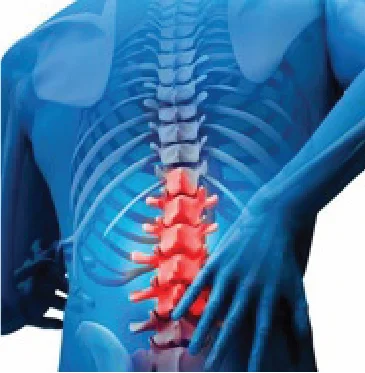 Spinal Cancer and Spinal Tumors